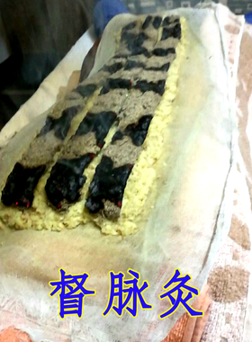 腹部脊柱艾绒模具督脉灸