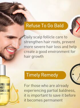 Ginger Hair Growth Products Prevent Hair Loss Essential Oil