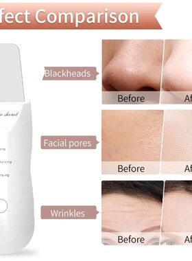 Electric Skin Scraper Peeling Blackhead Remover Ultrasonic D