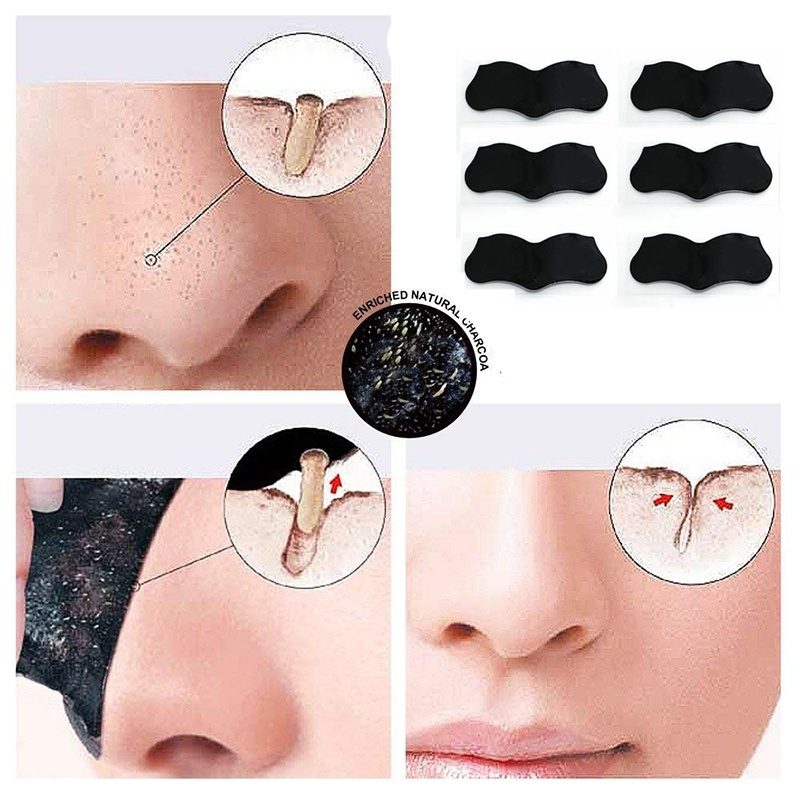 Blackhead Remover Nose Sticker Acne Treatment Mask Nose Stic - 图1