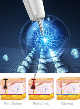 15 Level Laser Plasma Pen Skin Tag Remover Freckle Black Dot