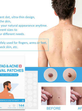 144pcs Skin Tags Moles Remover Patches Gift Wart Treatment