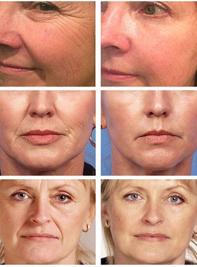 Retinol Remover Wrinkle Serum Products Lifting Firming Face