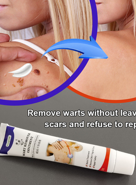 WartsRemoverOintment
