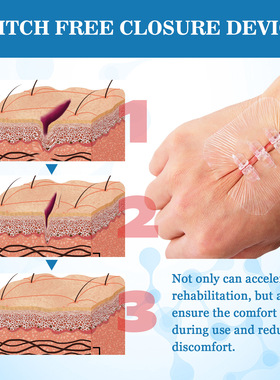 Convenient Fitting Wound Care Patch Fresh Breathable Skin-fr