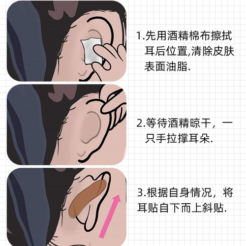 精灵耳贴强支撑隐形显脸小拍照变招风耳神器耳朵固定贴耳撑立耳器 - 图3