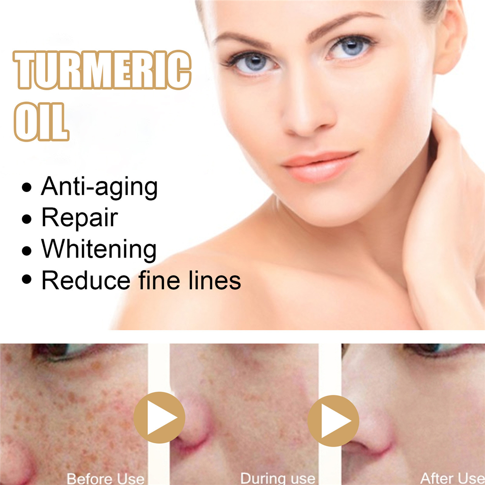 Turmeric Lemon Oil Skin Glow To Lightening Acne Dark Patches - 图2