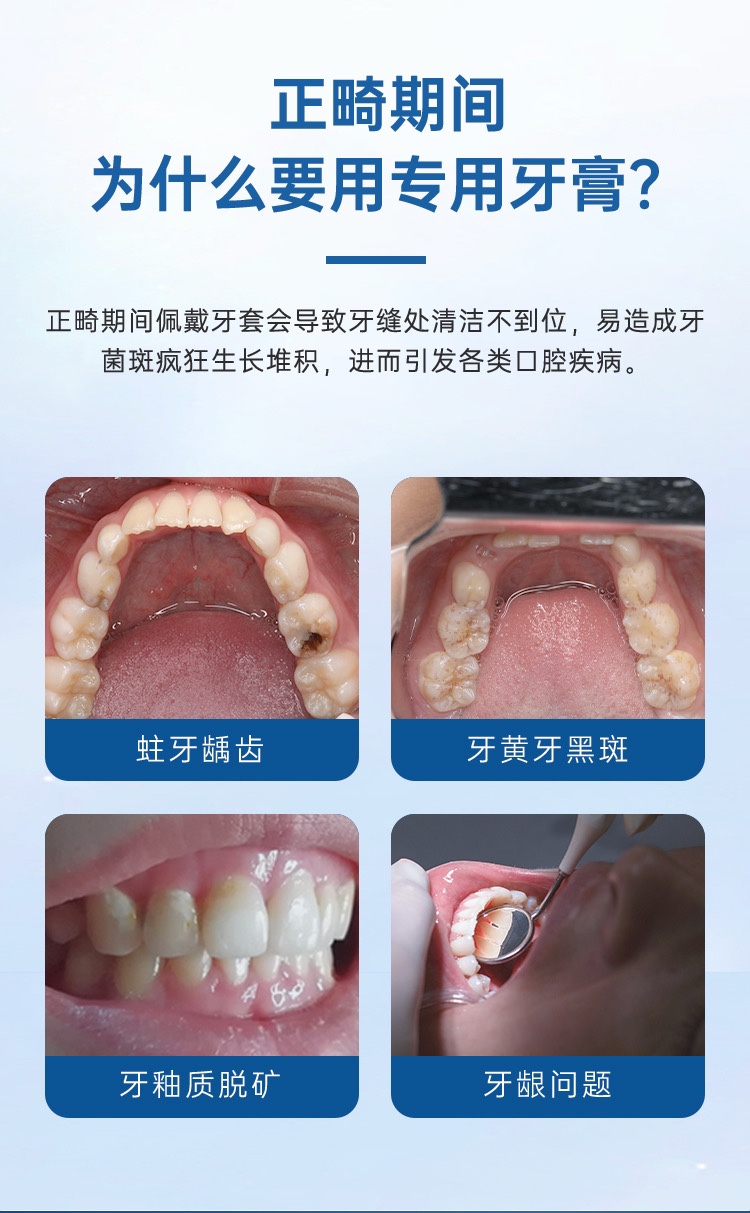 牙高医生菌斑可视牙膏防蛀含氟成人正畸护龈固齿牙菌斑检测显示剂 - 图0