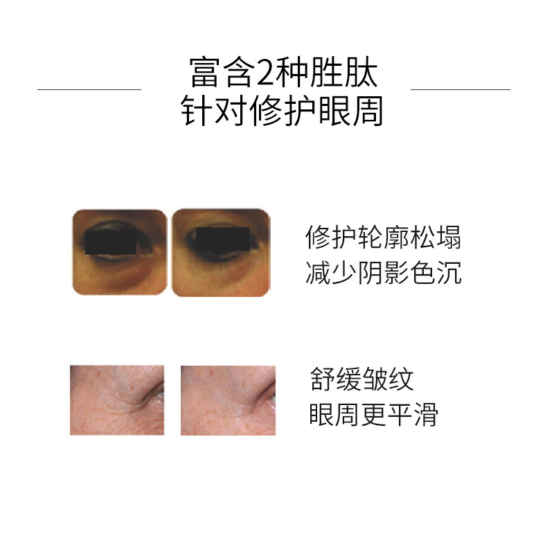endocare /安多可滤镜抗皱15ml眼霜 endocare安多可眼部精华