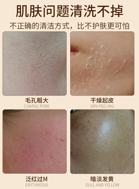 （净肤不紧绷）艾侬蔚蓝氨基酸洁面慕斯（干敏皮入）