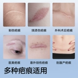 Жендская кесарева сечение