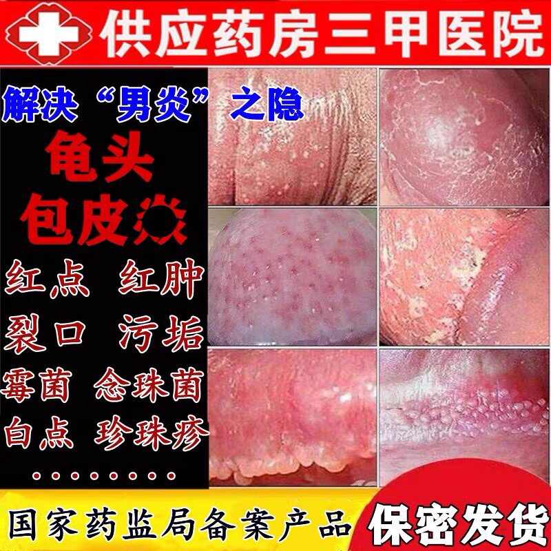 男性私处脱皮 新人首单立减十元 2021年12月 淘宝海外