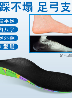 扁平足儿童矫正鞋垫足外翻内八字