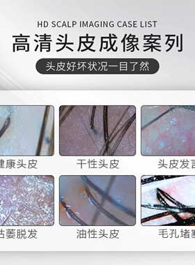AI智能高清头皮检测护理一体机