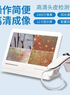 四光谱高清头皮毛囊检测仪
