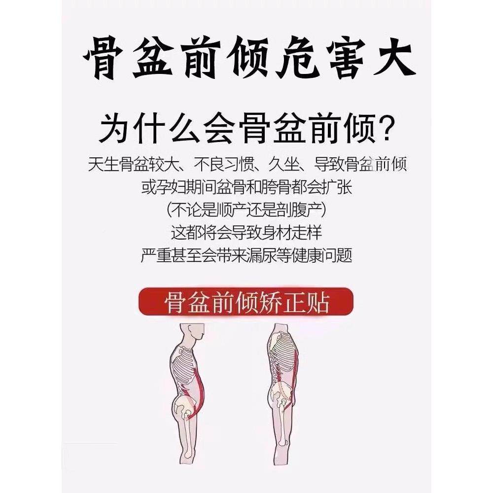 骨盆前出倾保健贴矫正收缩腹突假胯宽器专用修覆xo腿收胯神器女正,淘宝优惠券,粉丝福利购,淘宝优惠卷