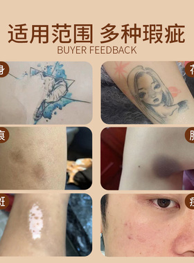 欧凯曼明星推荐纹身遮瑕膏可调色