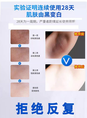 晒黑了修复快速变白紫外线防脖子手臂军训皮肤晒伤男女士涂抹霜Z
