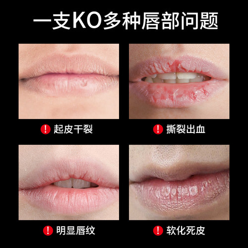 波斯顿薄荷水润型唇膏保湿补水淡化唇纹防干裂专用官方正品旗舰店 - 图0