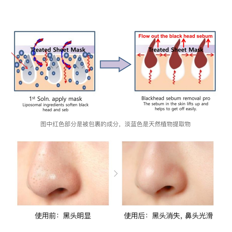 如薇RNW去黑头鼻贴草莓鼻导出液收缩毛孔深层清洁去粉刺男女专用 - 图1