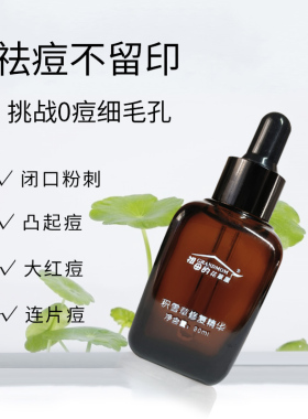 祖母油痘肌肤祛痘控油去痘印精华