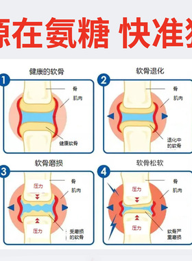 氨糖小绿管按摩膏肌肤关节涂抹膏