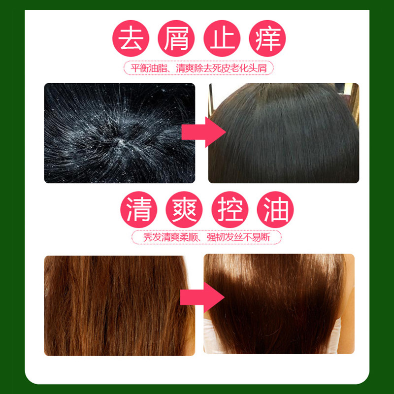 买一送一 神六破壁螺旋藻营养去屑洗发露 水润去屑柔顺亮发 420ml,淘宝优惠券,粉丝福利购,淘宝优惠卷