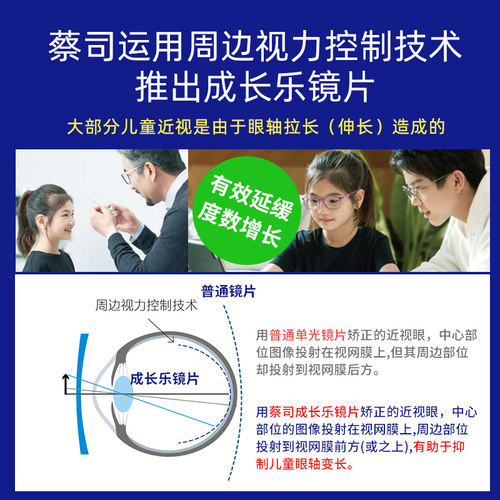 蔡司成长乐儿童防控镜片减缓近视离焦防控多焦点眼镜片小孩子少年 - 图2
