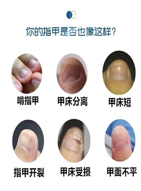 指甲竖纹修护营养精华液儿童