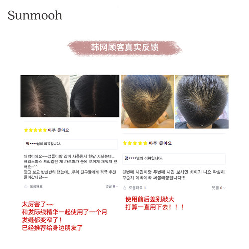 【Sunmooh】韩国专利防脱ViveLab防脱洗发水头皮护理蓬松去屑控油 - 图2