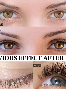 Fast Eyelash Growth Serum Eyelashes Eyebrow Enhancement Eyel