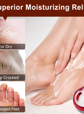 HeelsCrackFootCreamSkin