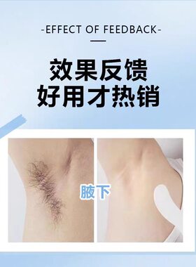 平价脱毛膏慕斯喷雾男女专用腋下腿脚部手臂温和不刺激不留