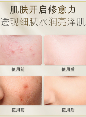 OKADY欧佩二裂酵母润养修护套装