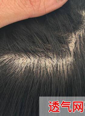 Wig Men's Top of Head Delivery Needle Replenishment Wig