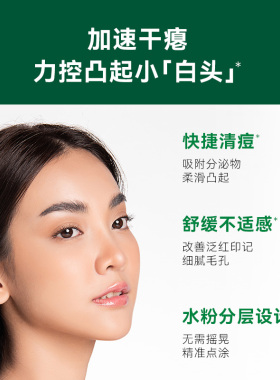 MB祛痘小粉瓶速效舒缓红肿白头痘