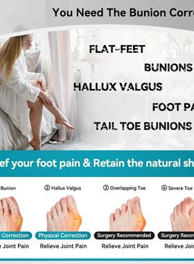 Hallux Valgus Bunion Corrector Toe Separator Orthotics Feet