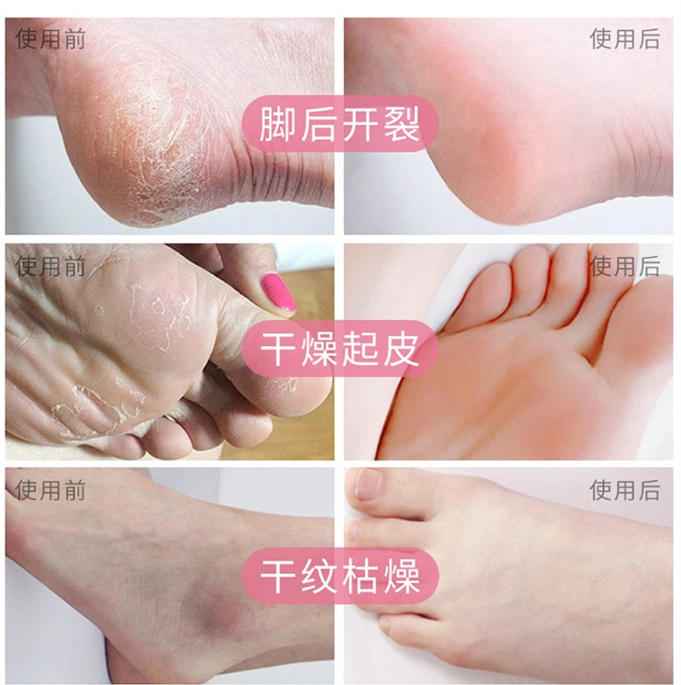 泰国皇冠牌香蕉膏脚后跟龟裂香蕉精霜正品手足脚开裂脱皮拍一送一 - 图0