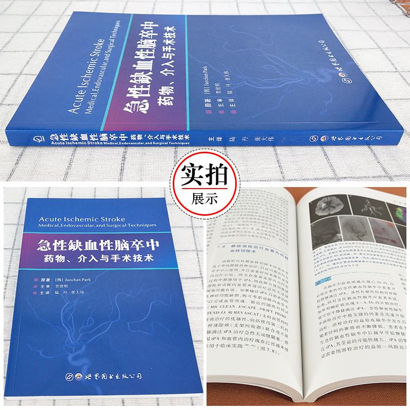 急性缺血性脑卒中药物介入与手术技术陆丹主译脑卒中病理生理手术治疗方法探讨神经内外科急诊放射科医生适用医学书籍世界图书-图0