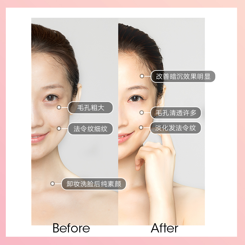 mior美容工具旗舰店Mior美容仪器家用洗脸毛孔清洁面部按摩导入仪提拉紧致嫩瘦脸神器2