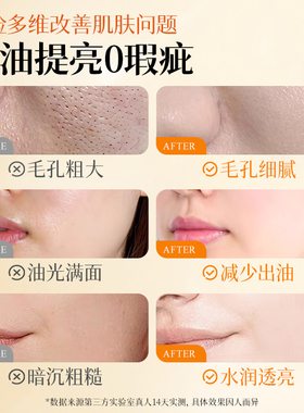 胖东莱甄选|金盏花糙米爽肤水