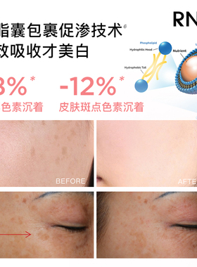 RNW如薇377美白淡斑精华油