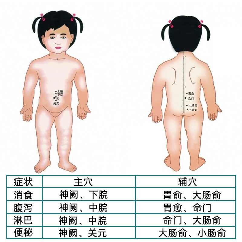 琼森小儿肠系消食贴儿童润肠通便 皇圣堂膏药贴（器械）