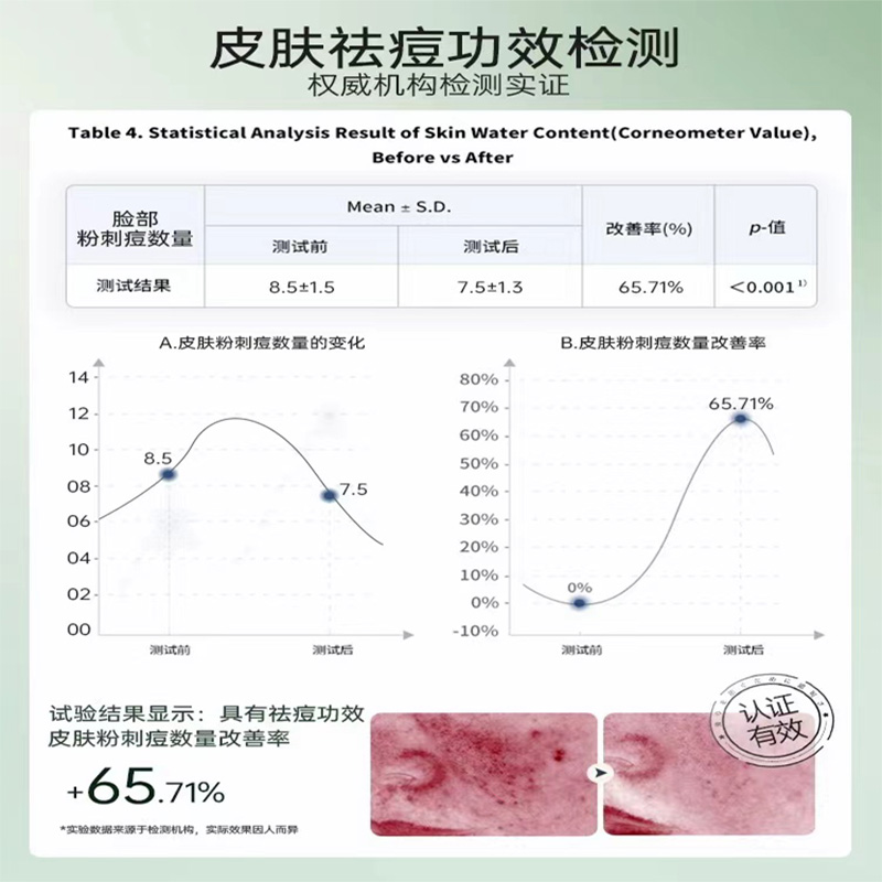 RUYI儒意祛痘面膜水杨酸淡化痘印斑补水修护保湿舒缓复男女士专用 - 图3