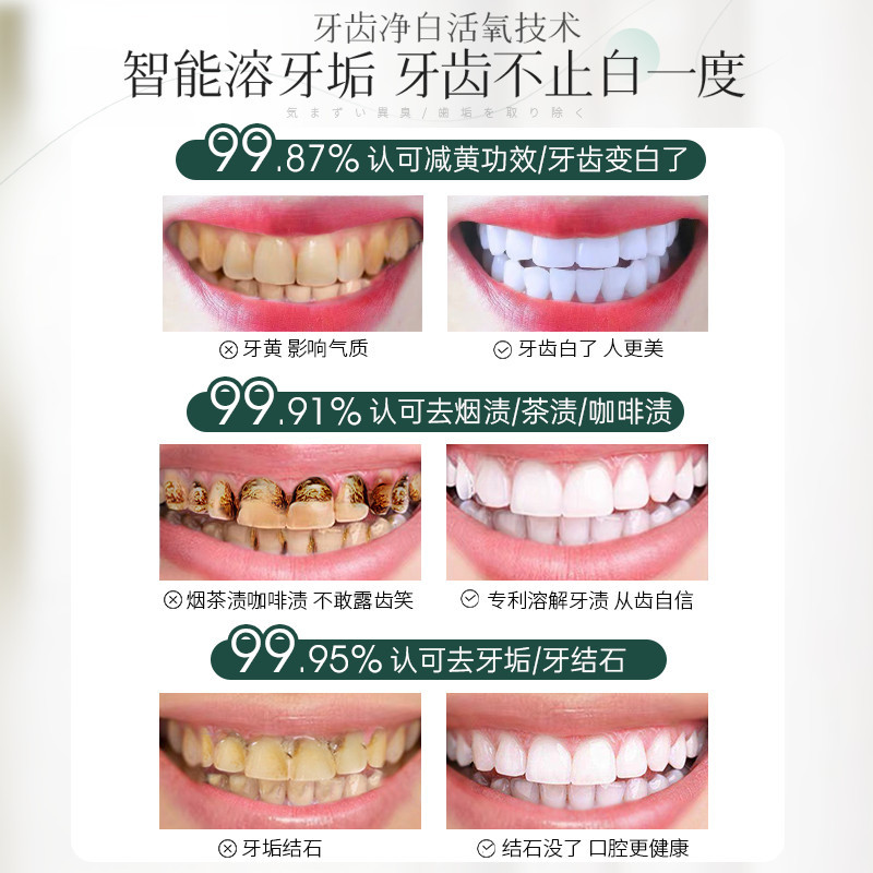 洁牙粉去黄牙齿美白益生菌速效黄牙牙渍结石牙垢白口臭污垢洗神器 - 图2