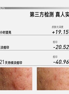 毕生之研VC精华小棕瓶20%原型维c密集亮肤精华液提亮肤色淡化痘印