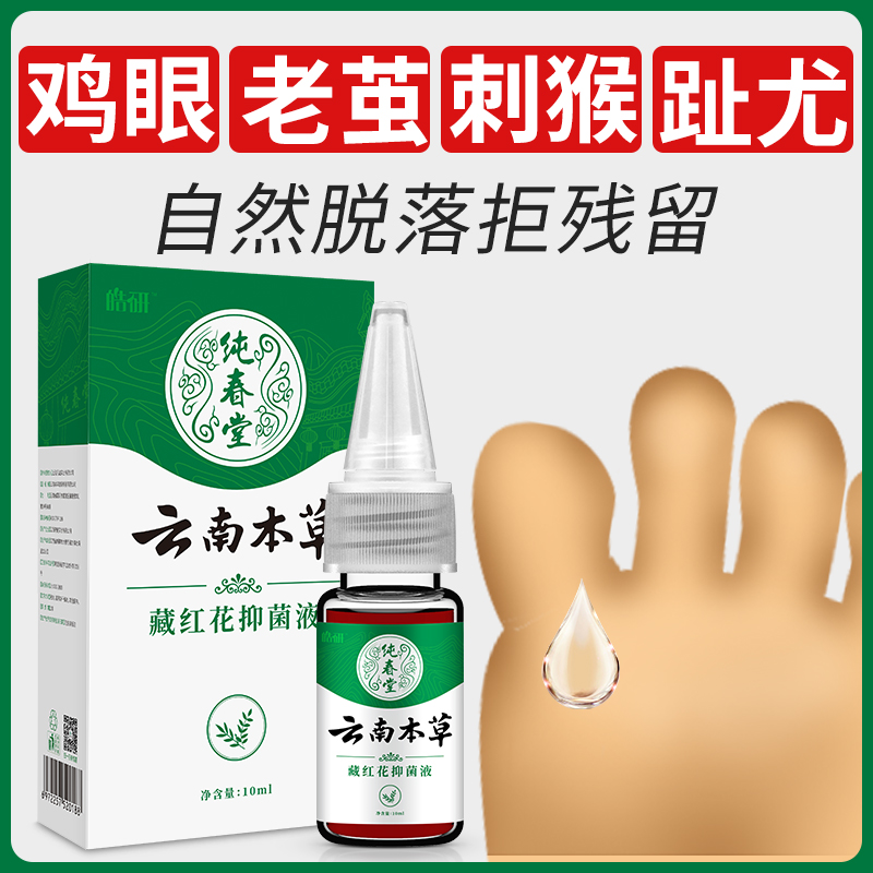 云南本草去手足部鸡眼膏 皓研裕亚足部健康