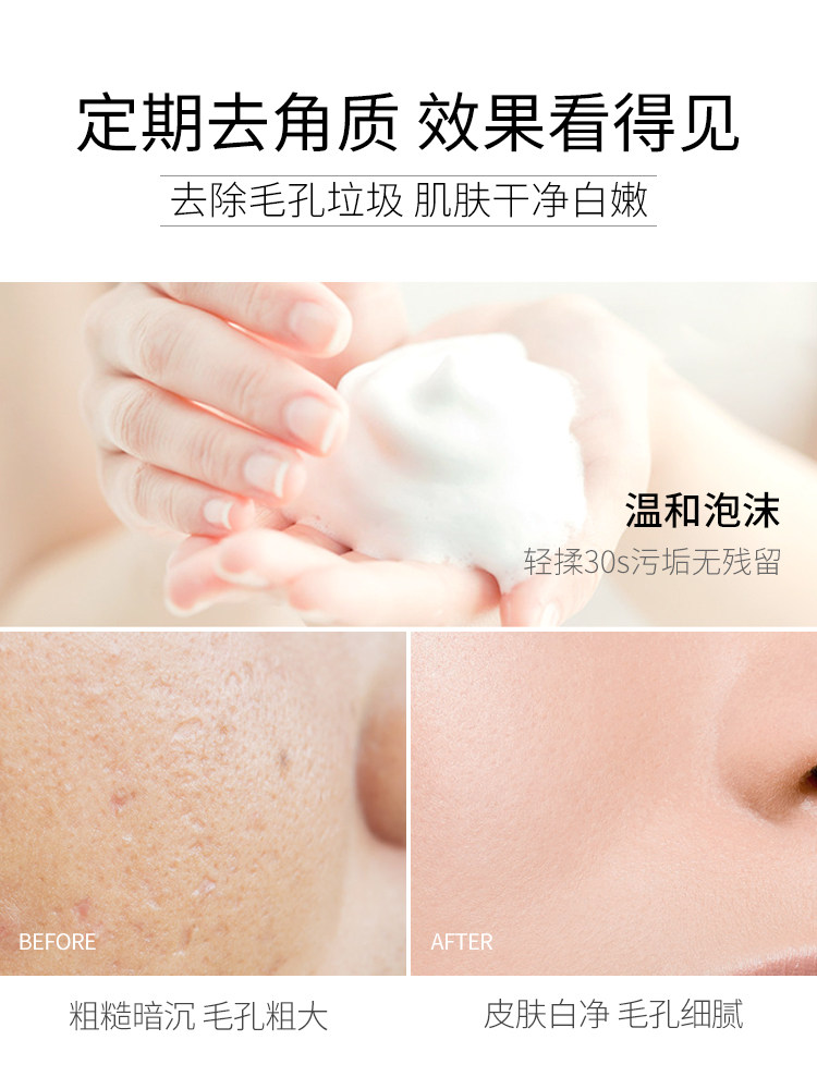 朵拉朵尚去角质慕斯面部男士去黑头 朵拉朵尚万物生面部磨砂/去角质