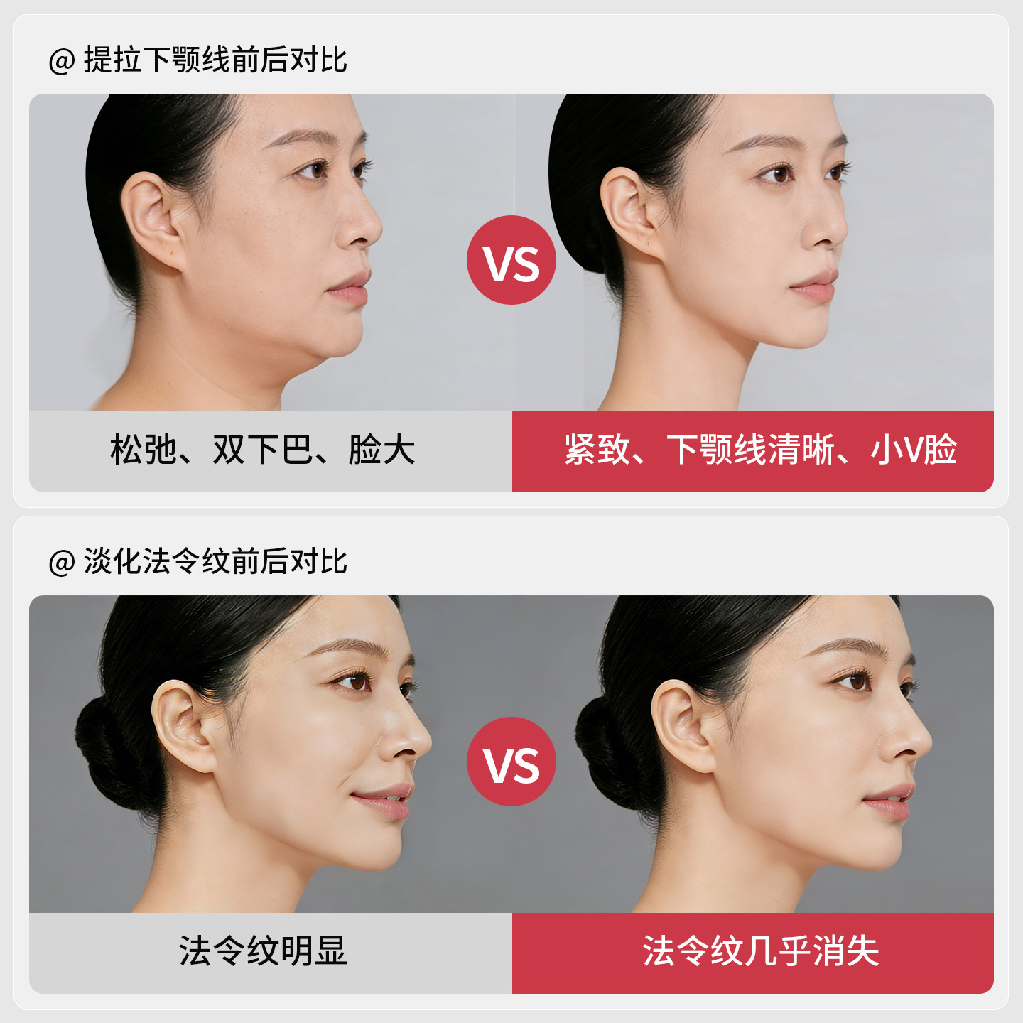 New Facial Yoga Dumbbell Lifts, Firms, and Firms Apple Muscles, Jaw Line, Fades Nasal Lines, Female Face Slimming Massage Artifact
