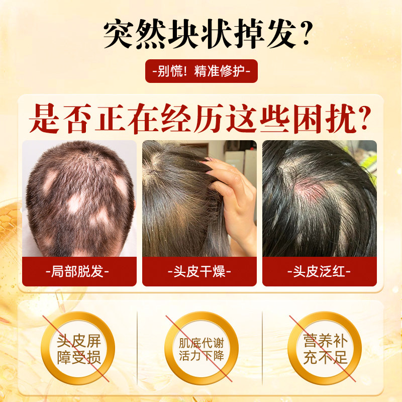 章光101参养源液头皮精华液滋养修护斑块秃人参植物正品官方旗舰,淘宝优惠券,粉丝福利购,淘宝优惠卷